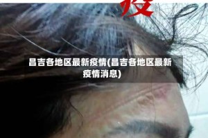 昌吉各地区最新疫情(昌吉各地区最新疫情消息)